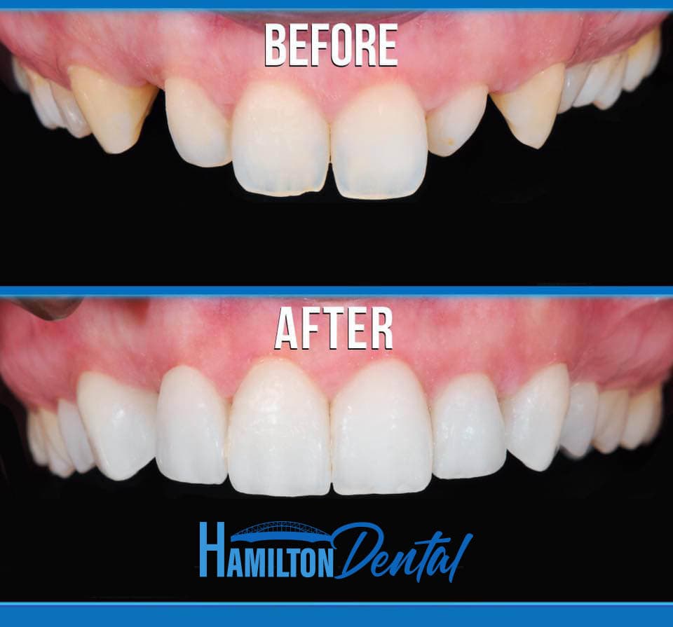 Cosmetic Dentistry Hamilton