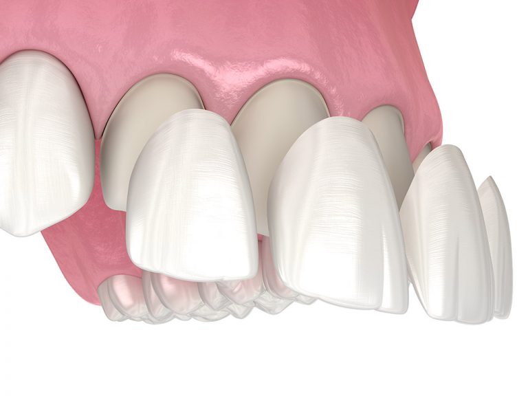 Cosmetic Dentistry in Hamilton Cosmetic Dentistry Near You