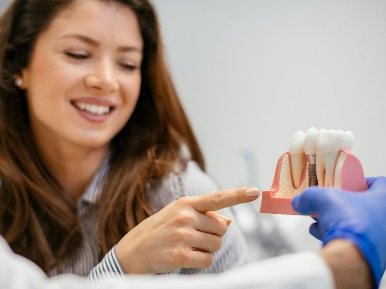 Dental Implants Hamilton Affordable Implants Crowns in Hamilton