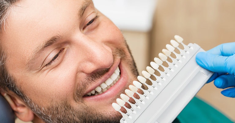 How Much Do Veneers Cost in Canada