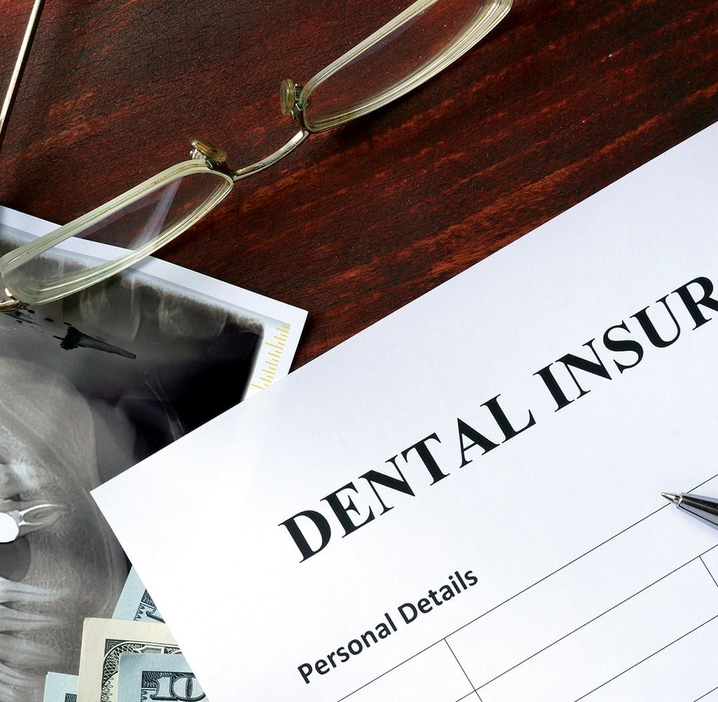 Insurance Cover the Cost of Veneer Dentistry