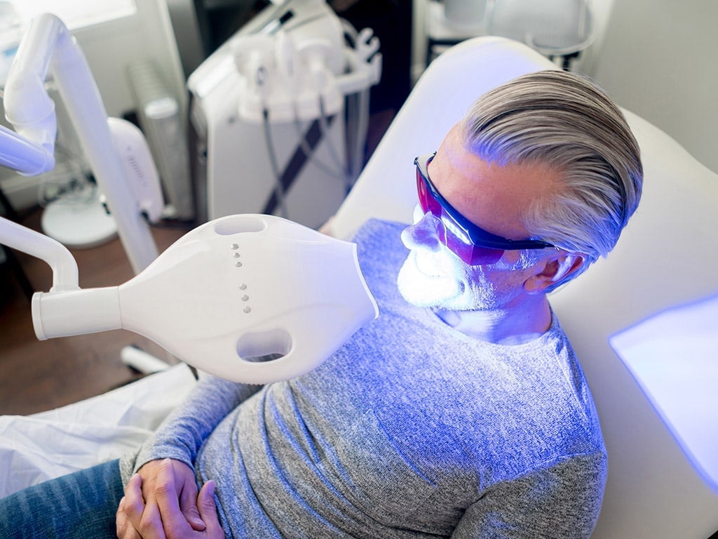 Teeth Whitening Services in Hamilton Dental