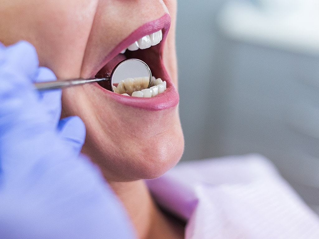 What is Preventative Dentistry