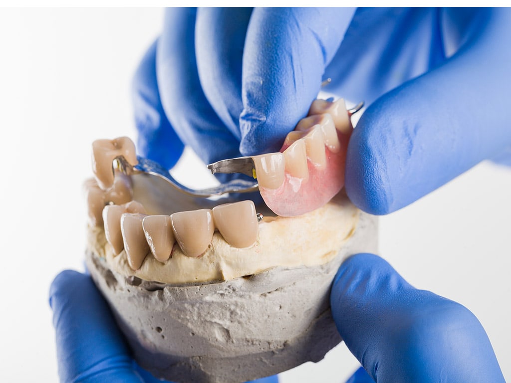 Partial Dentures Hamilton Dental