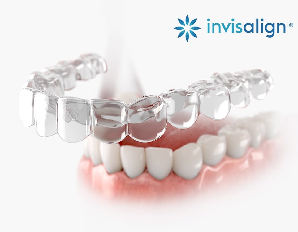 Invisalign Dentistry Hamilton